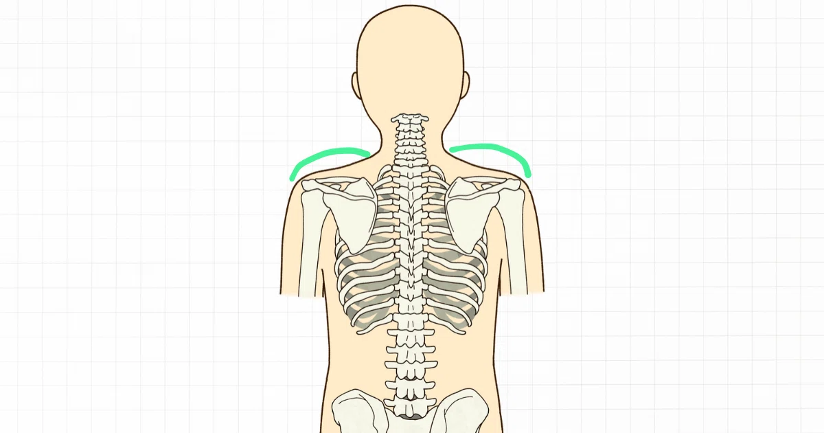 People with uneven shoulder heights. The cause might not be the ...