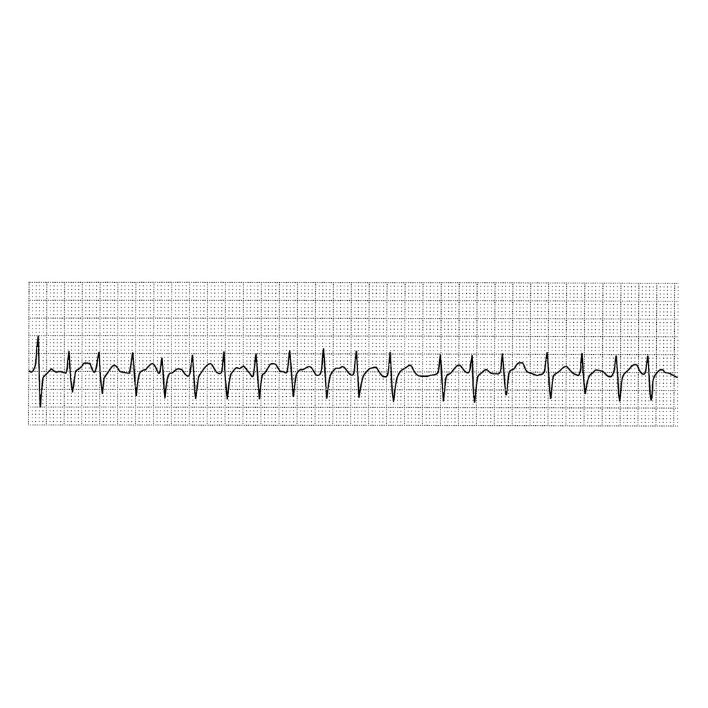Emergency Life-Saving Technician 47th National Exam - Problem D ...