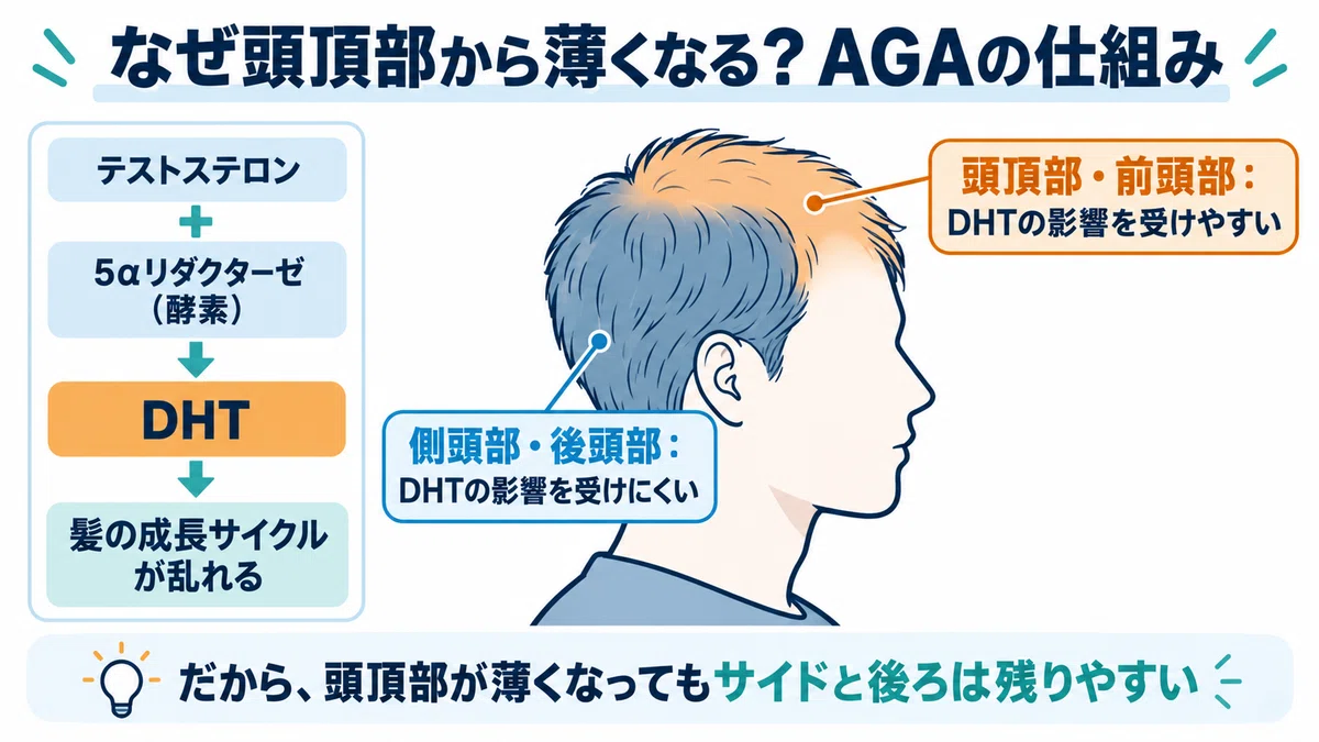 Can thinning hair on the crown be cured? A 32-year-old with a thinning ...