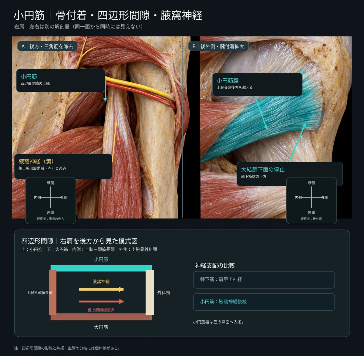 [1 Muscle a Day ⑨] Teres Minor | Learn its position, attachment, and ...