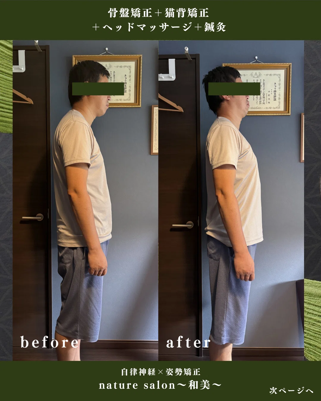 [Is 'Posture' the Cause of Your Mysterious Fatigue?] If You Don't ...
