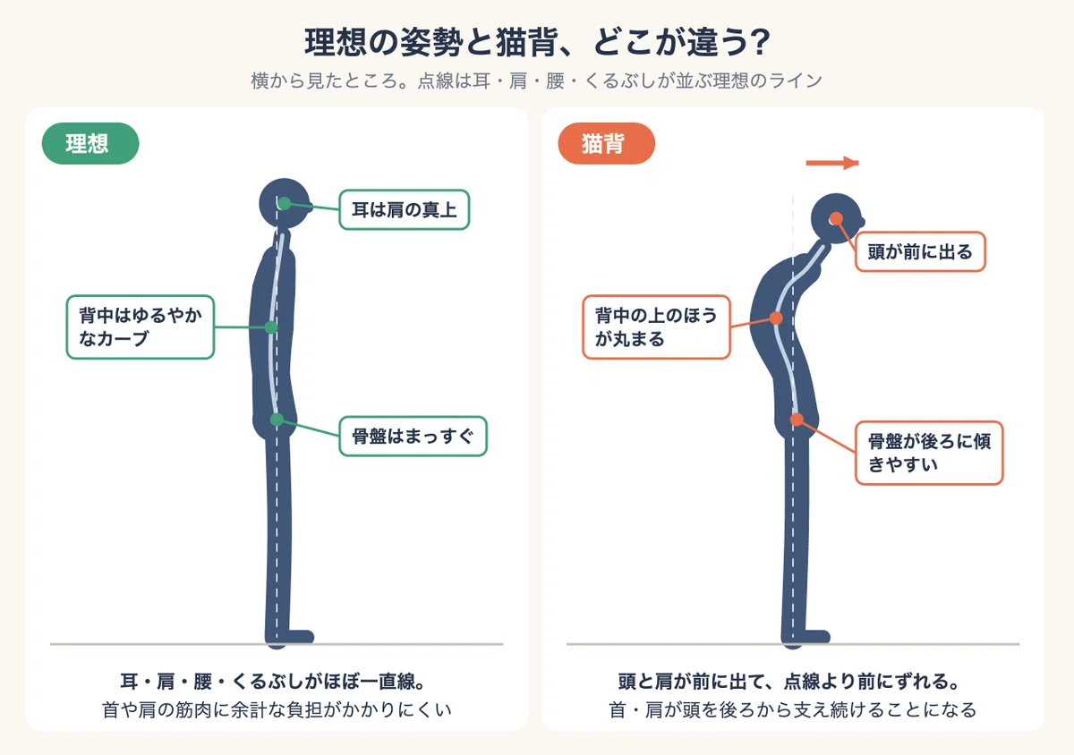 [11 Years of Experience as a Trainer] Do you have hunched shoulders? 5 ...