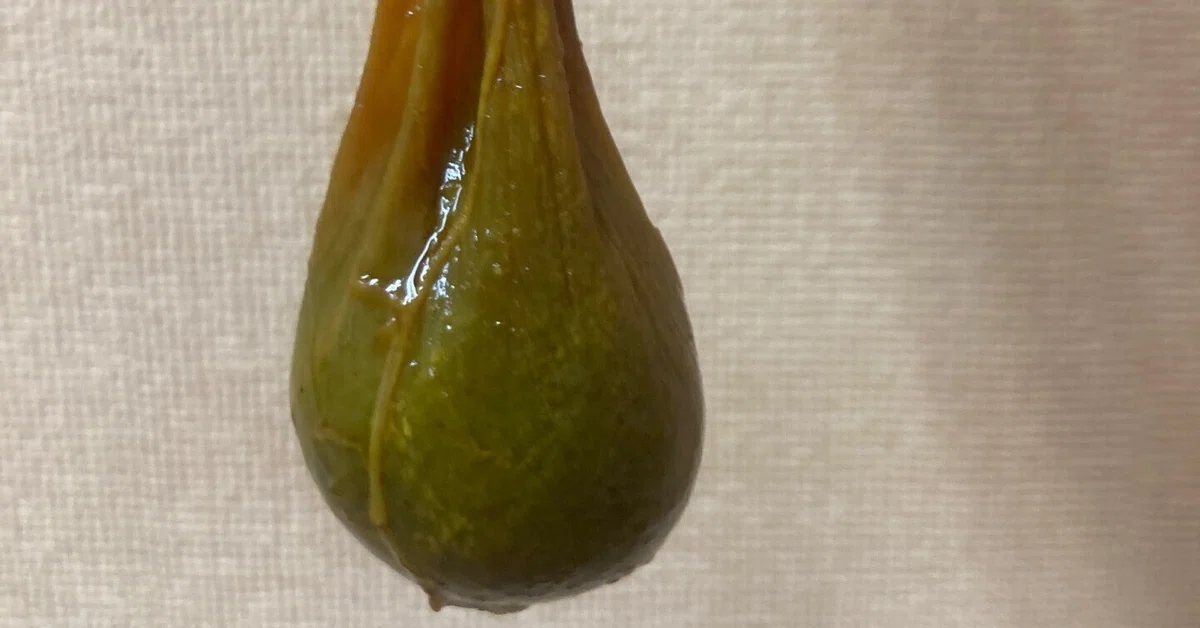 猪胆の作り方|縁里庵かつもと鍼灸院