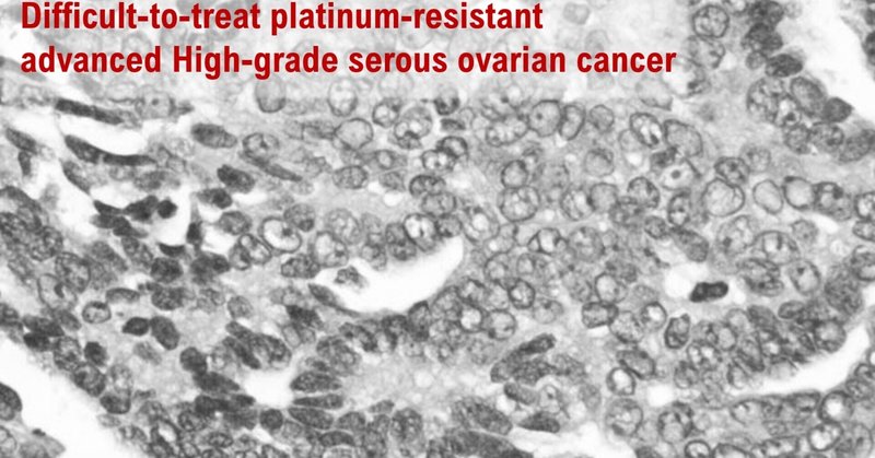 Importance of development of antitumor agents for platinum-resistant ovarian cancer in Japan