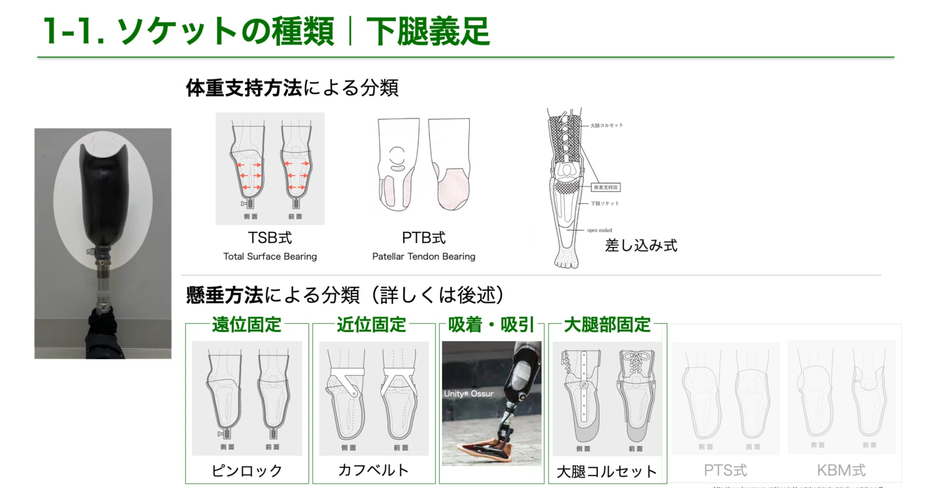 下腿義足のソケットの種類｜義肢リハ医🦾🦿