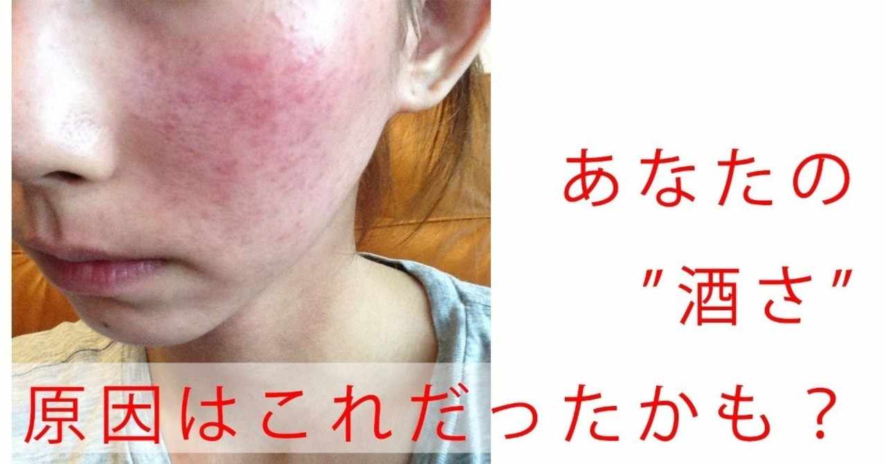 気をつけて ポーチ 密接に 酒 さ 化粧 水 kamersan net
