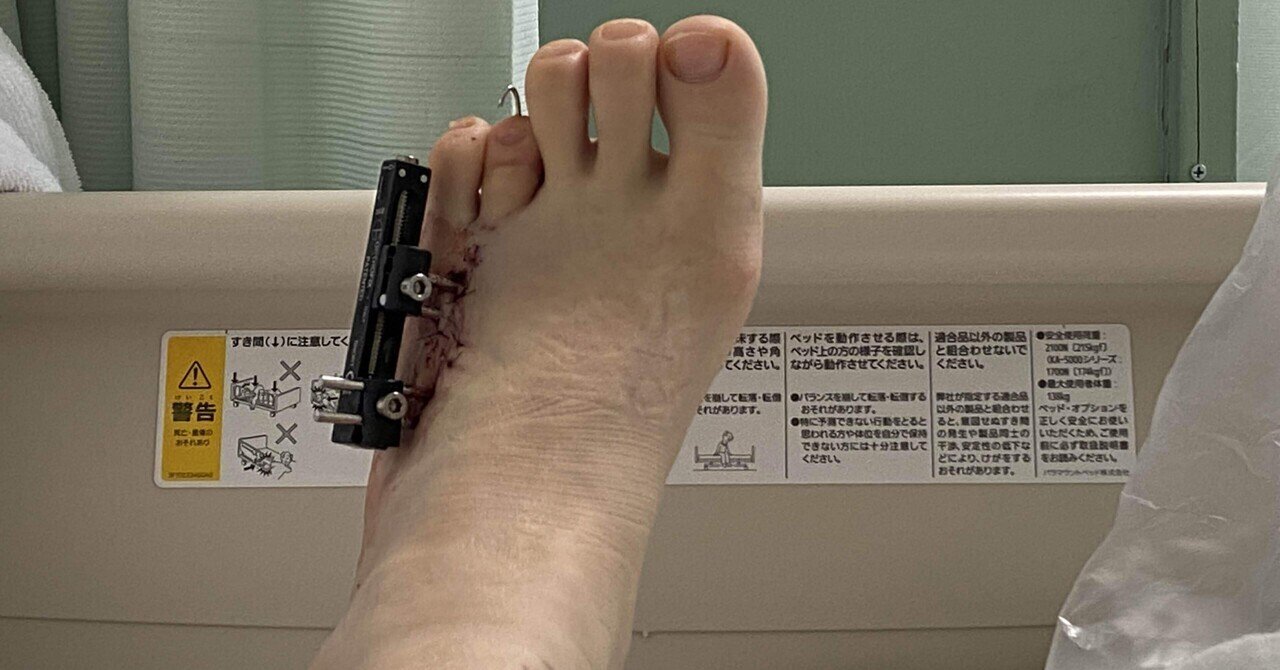 これらの手順に適した候補者は誰ですか?