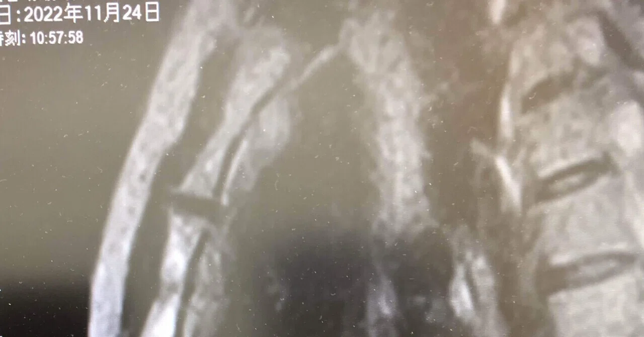 [Viewer Discretion Advised] Contains images of a wrecked car - Six ...