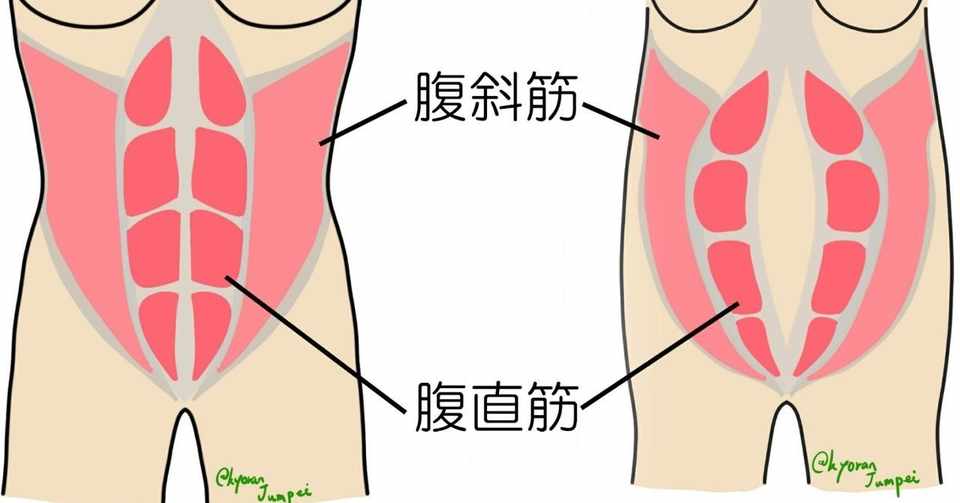 18 5月24日 妊婦の産後ケアのイラスト 腹直筋離開 じゅんぺい