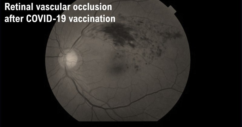 Number of cases of retinal vascular occlusion after mRNA-based COVID-19 vaccination in Japan
