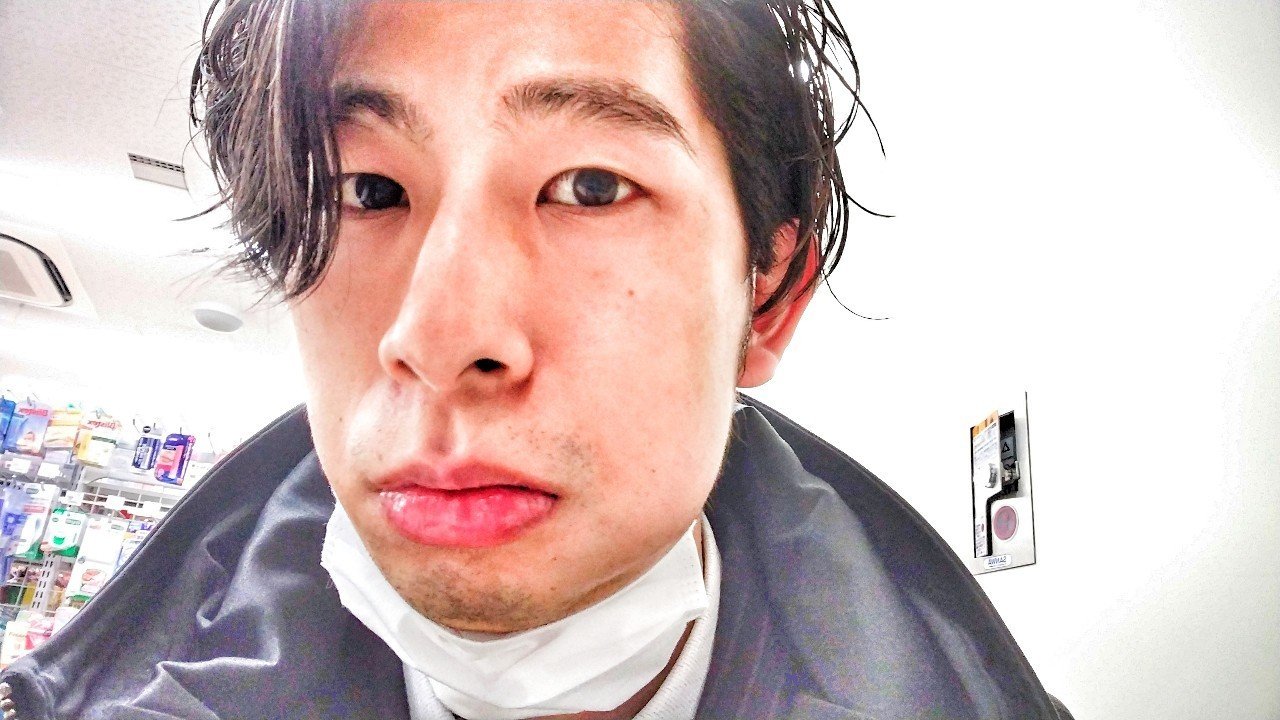 左頬が腫れたのは君のせい はやぶさ Com Note