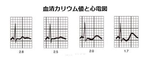 手術で治癒することができます