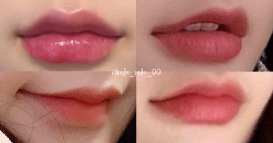 今まで通った唇フィラーの病院まとめ ろむ Note