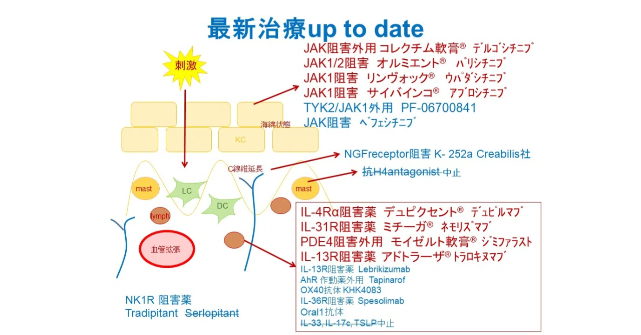 アトピー性皮膚炎 最新治療2023.5｜Dr.アトピー@患者でもある皮膚科医