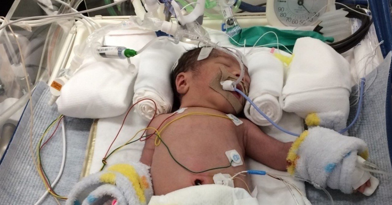 新生児低体温療法 の新着タグ記事一覧 Note つくる つながる とどける 新生児低体温療法 の新着タグ記事一覧 Note つくる つながる とどける