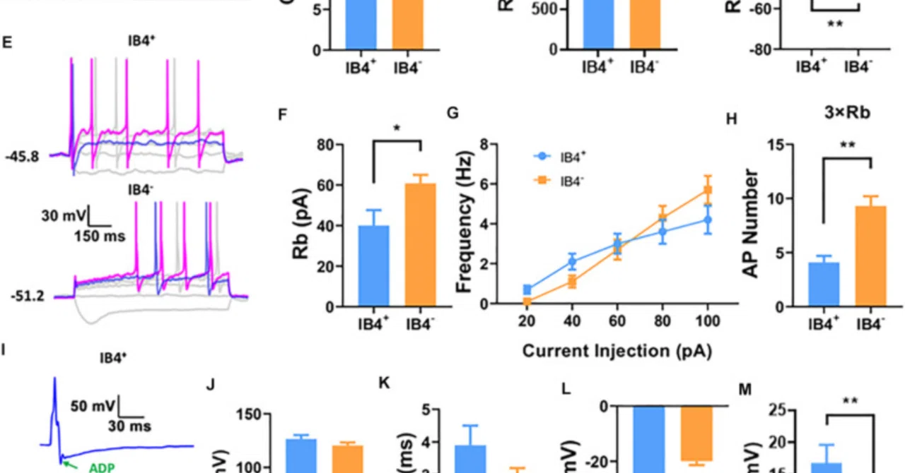書記が論文読むだけ#1232-Oxaliplatin Depolarizes the IB4- Dorsal Root Ganglion ...