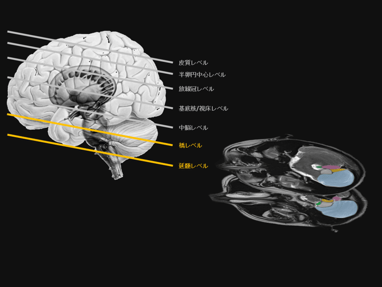 脳画像×小脳機能⑭ ～小脳核～｜かずん