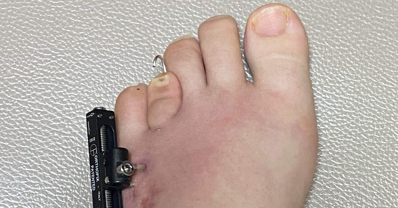 この処置の副作用やリスクは何ですか?