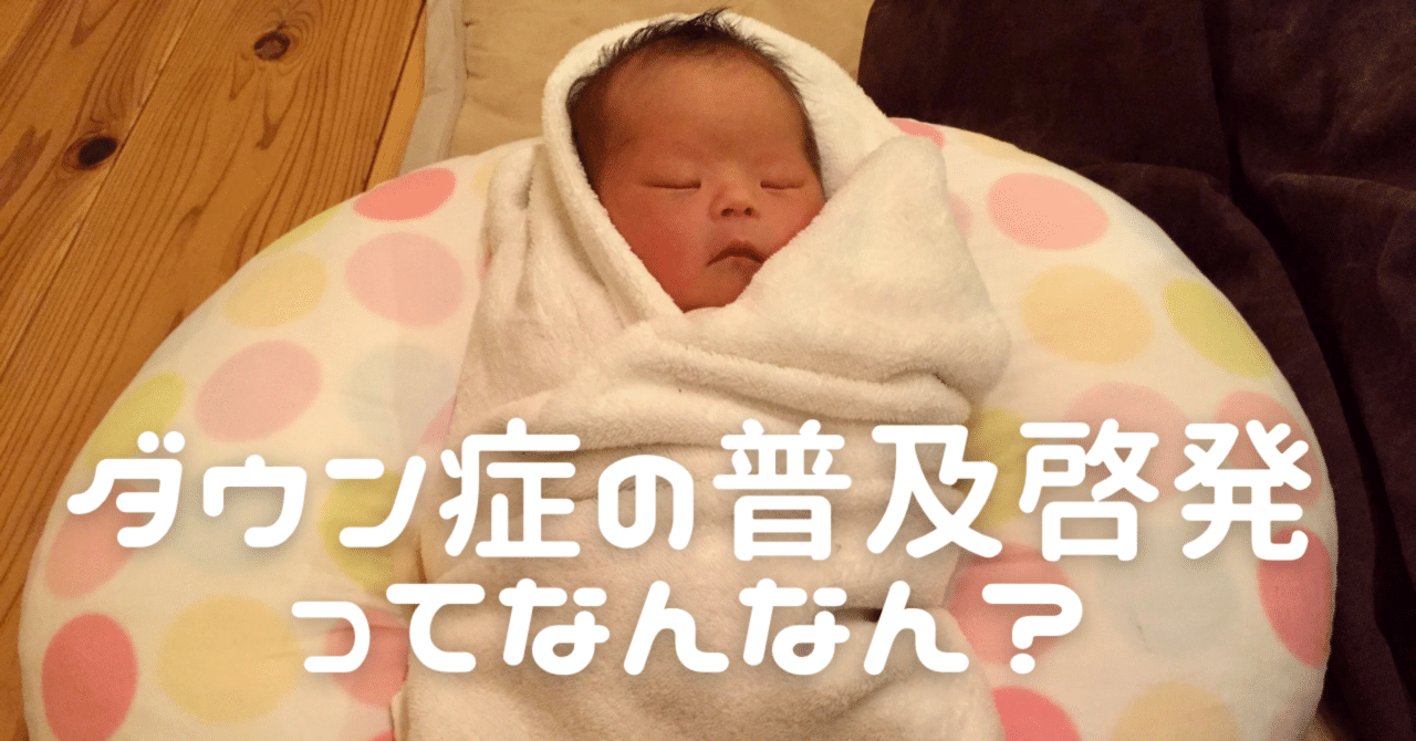 【中古本】ダウン症児の言語発達における共通性と個人差 61wczXhnbhL._AC_UL210_SR210,