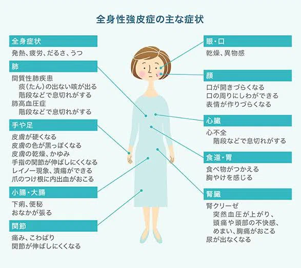 難病になって4年半を振り返って。強皮症になって大変だったこと、学んだこと。｜つだ かい