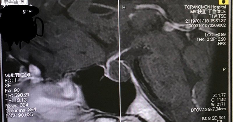 10万人に1人の難病と闘う男の話 緊急入院編 バンドマン先生r note