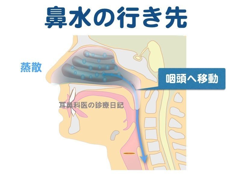 花粉 症 喉