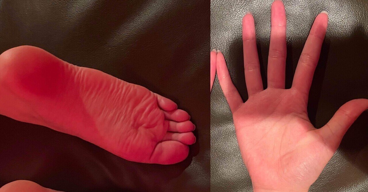 人妻　生足 身長174cm 足のサイズ26.5cm 中条あやみ似の美女の手足の測定、比較｜比較ライフ