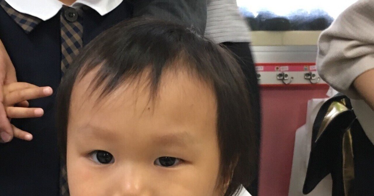 頭蓋骨癒合症の手術はどのような手順で行われますか?