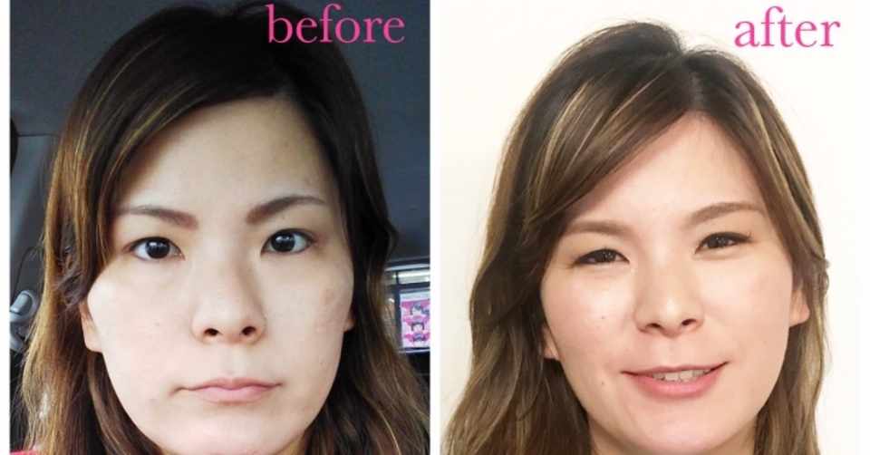 眉間のスキは心のスキ 優しい雰囲気に変わったポイントを解説 いずみ Note