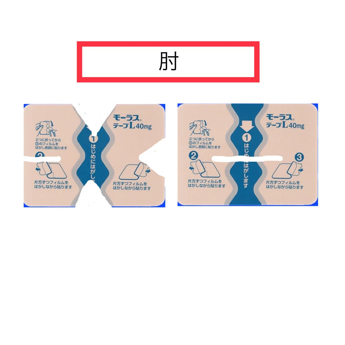 [新人薬剤師向け]貼付剤の知識｜Piyo薬