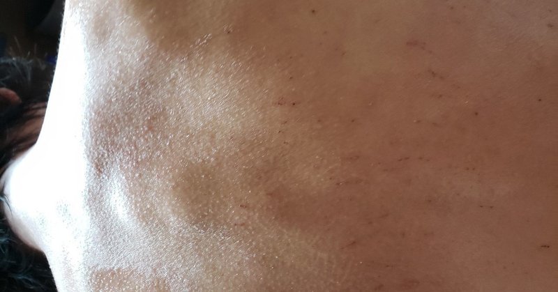 傷ばかりの背中のざらざらが じゅもく Note