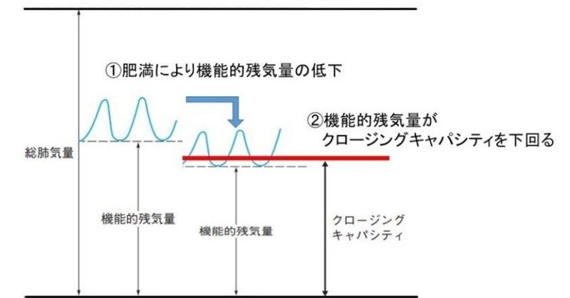 0027 肥満患者の呼吸管理の難しさ 獣医麻酔 集中治療学 Note