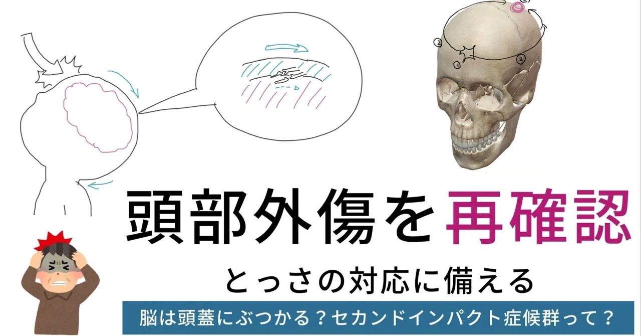 頭部外傷を再確認する｜理学療法メモ