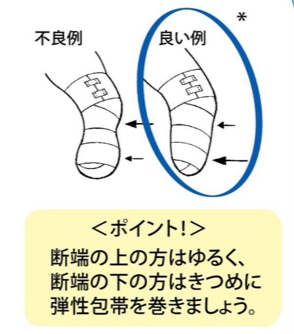 弾性包帯の巻き方 サンダー 謙虚 バード Note