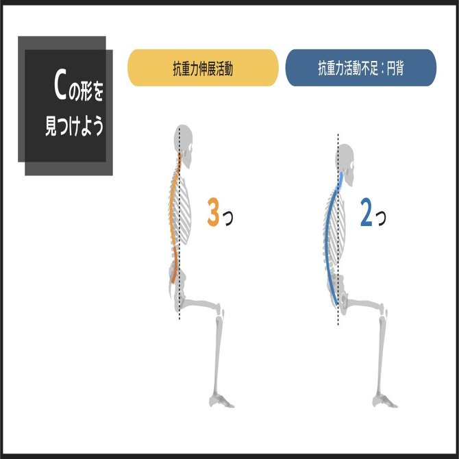 姿勢分析を今より速くするために明日からできること：座位編その１｜小松 洋介｜リハビリ・介護の教科書クリエイター, image size:1280x670