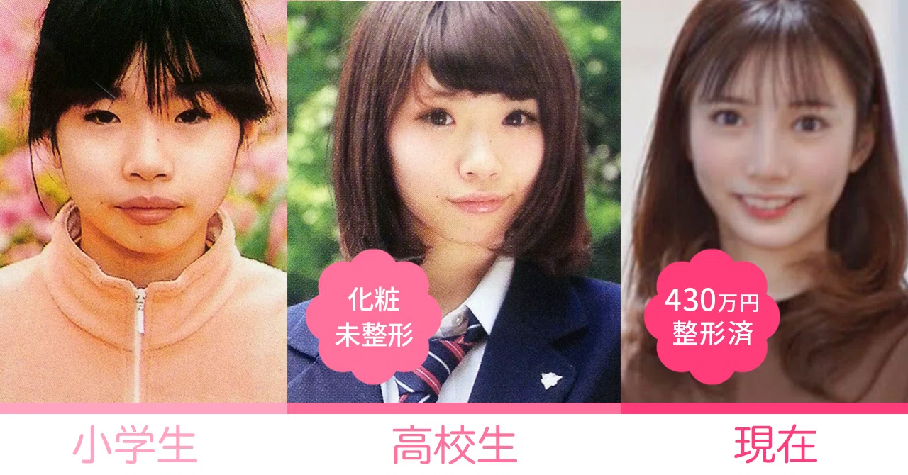 美容整形をした女子大生の私が、起業して投資家から資金調達した話