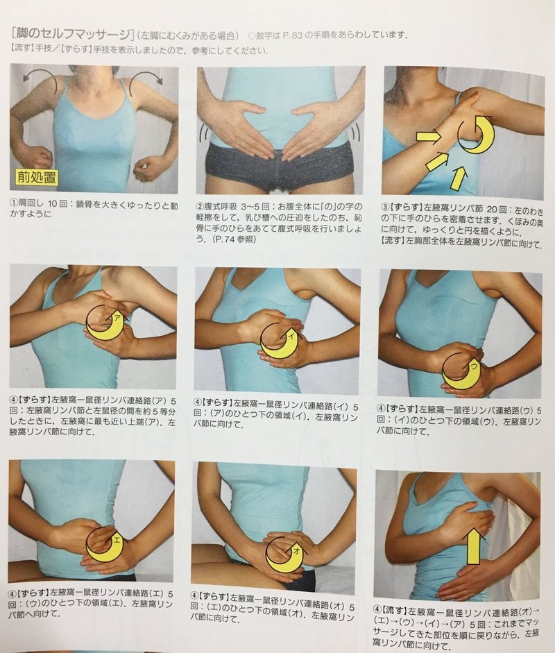 Q 下腹部 陰部の浮腫ってどうしたらいいの Olas For Cancer Survivor Note Q 下腹部 陰部の浮腫ってどうしたらいいの Olas For Cancer Survivor Note