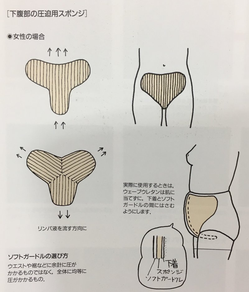 Q 下腹部 陰部の浮腫ってどうしたらいいの Olas For Cancer Survivor Note Q 下腹部 陰部の浮腫ってどうしたらいいの Olas For Cancer Survivor Note
