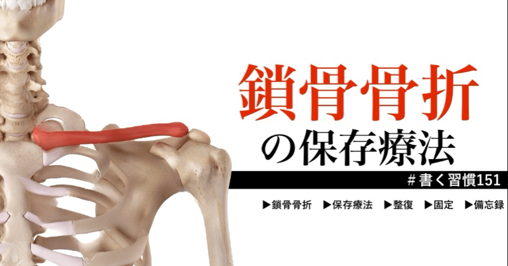 鎖骨骨折の保存療法」＃書く習慣151｜整形外科で働く柔道整復師