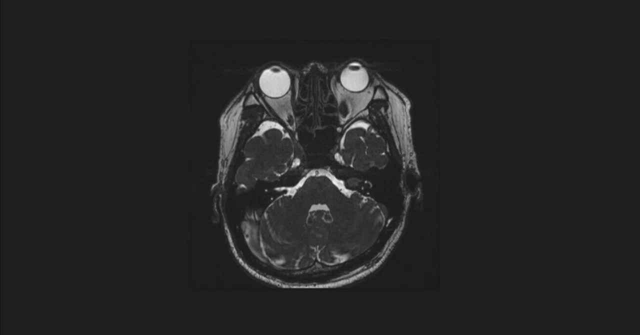 Radiologic Technologist's Honest Thoughts. 6｜現役クソ放射線技師