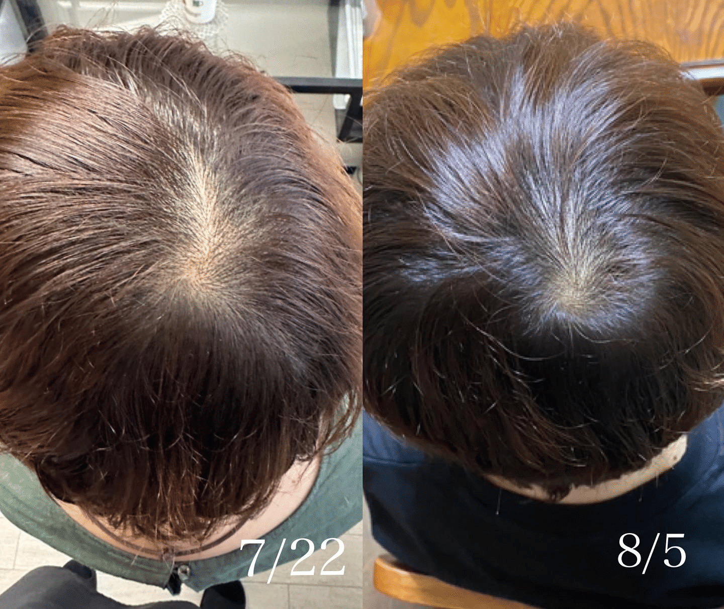 プロセルセラピーズ】頭皮｜エステ•スカルプ講師/セラピスト Maiko