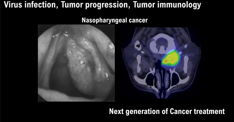 ウイルス感染陽性の悪性腫瘍では、腫瘍指向性免疫活性化が高い可能性