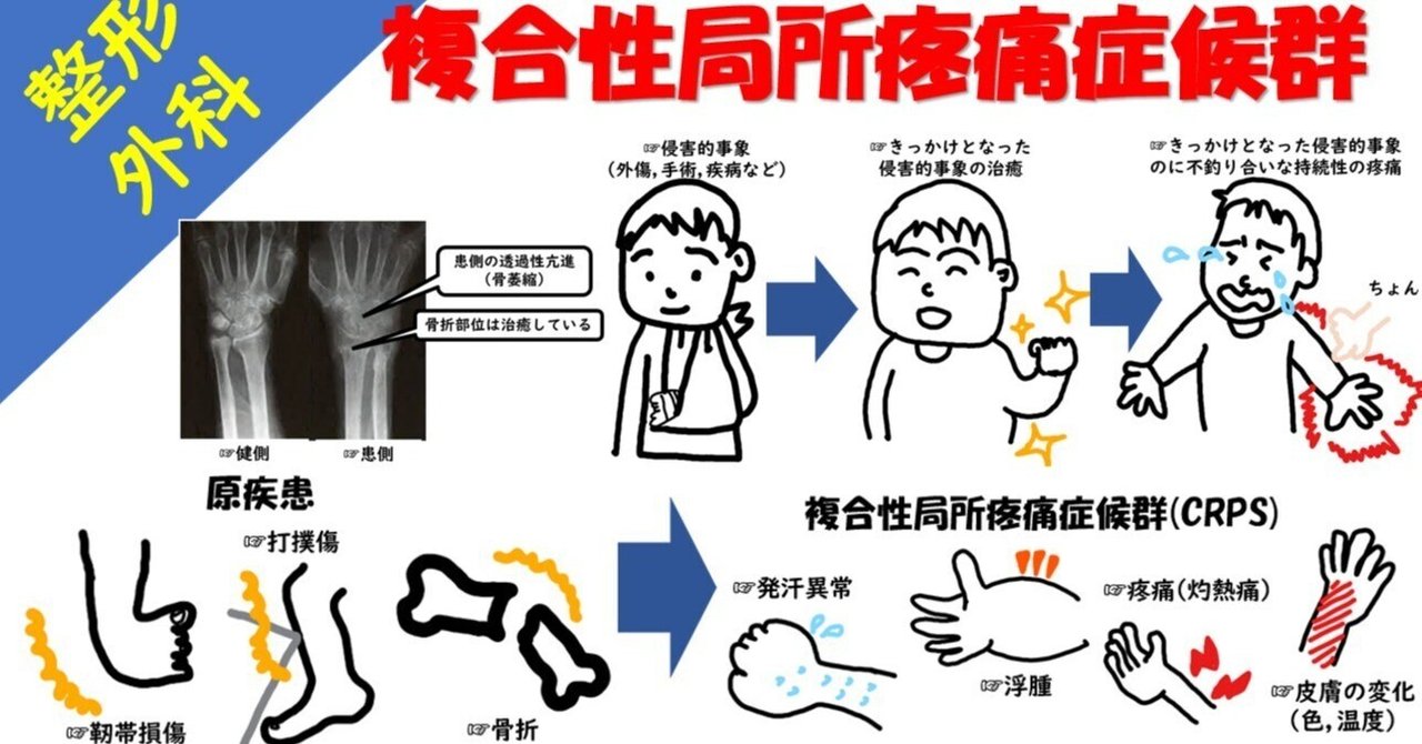 CRPSの症状は何ですか?