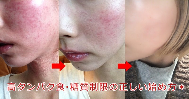 美肌 Kawa93 Note 美肌 Kawa93 Note