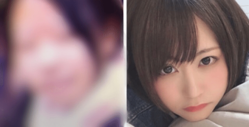 美容整形手術 の定番タグ記事一覧 Note つくる つながる とどける