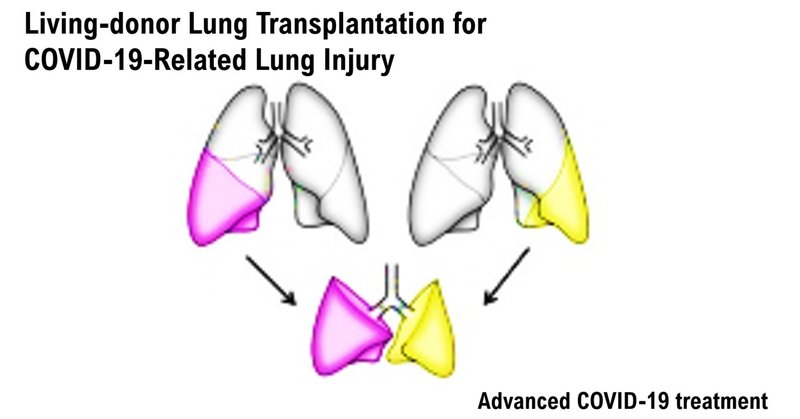 新型コロナウイルス感染症関連肺機能不全に対する生体肺移植