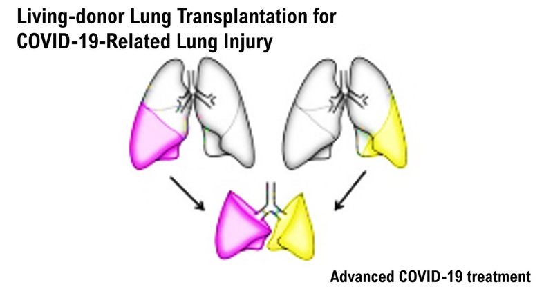 Living-donor Lung Transplantation for COVID-19-Related Lung Injury