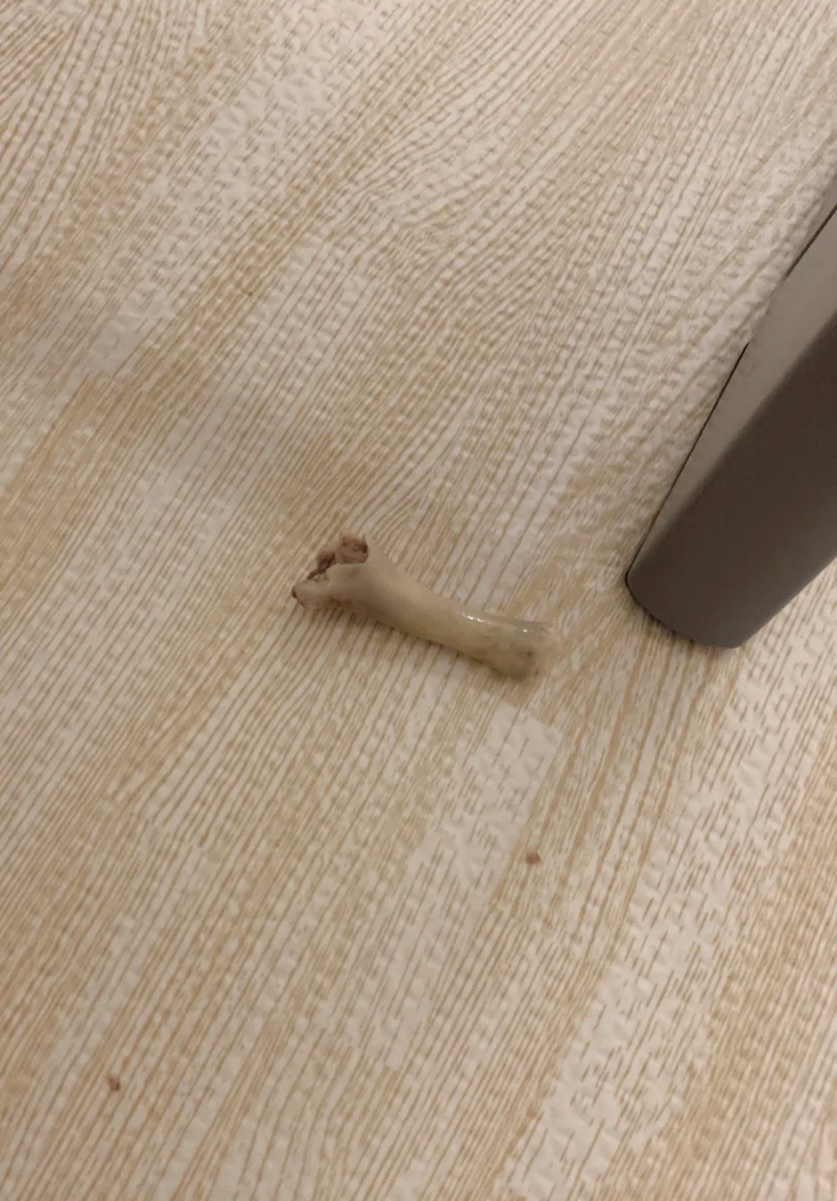骨の画像