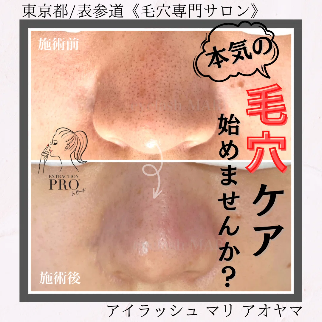 表参道にて 毛穴エクストラクションプロ 始まります。|石川麻理 表参道にて 毛穴エクストラクションプロ 始まります。|石川麻理