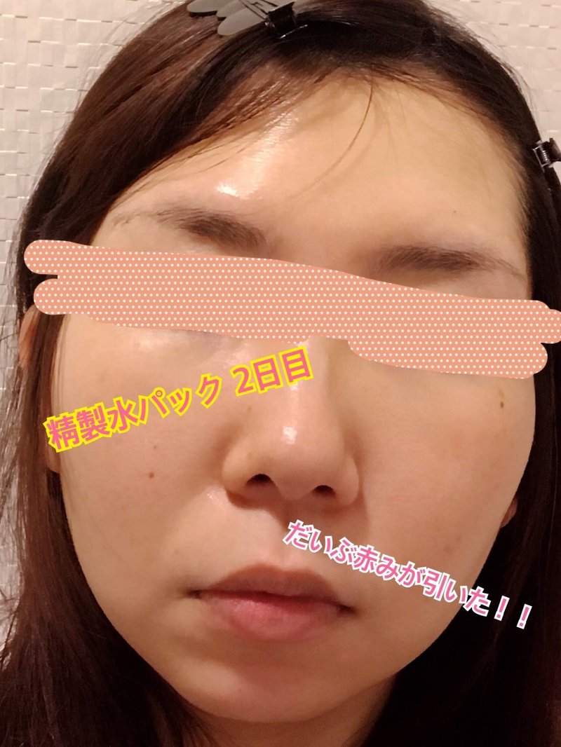精製水パックでモチすべ肌になる ぴよちゃん Note 精製水パックでモチすべ肌になる ぴよちゃん Note